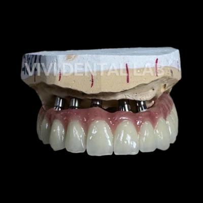 China Total Implant PFM Bridge China Dental Lab for sale