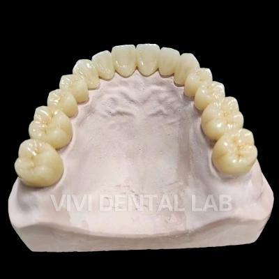 China Dental Full Bridge Total Bridge Professional Complete Bridge for sale