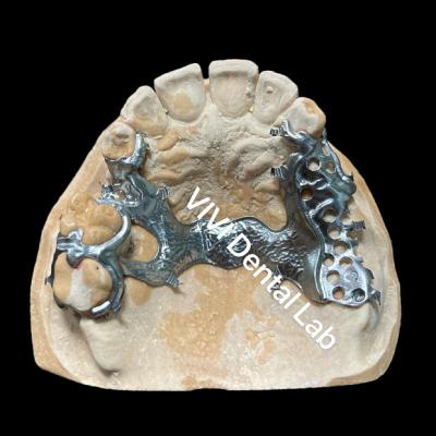 China Lightweight Titanium Partial Dentures Exocad 3shape Digital Dentures for sale