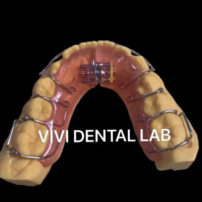 China Dentes fixos expansor de palato profissional para maxilar mandibular à venda