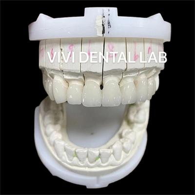 China High Esthetics Zirconia Dental Lab Crowns Bridge With Layered Porcelain for sale