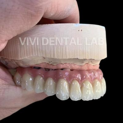 Cina Impianto dentale estetico ISO Corona Impianto dentale ponte preciso in vendita