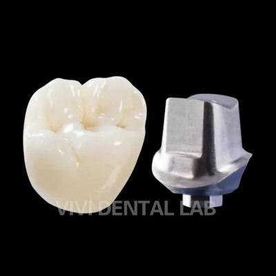 China Implante dental de cemento resistente a las virutas Corona de titanio Dientes de circonia Coronas en venta