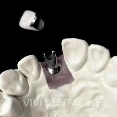 China Implante Dental Personalizado Coroa Ni Be Free Abutment Base de Titânio à venda