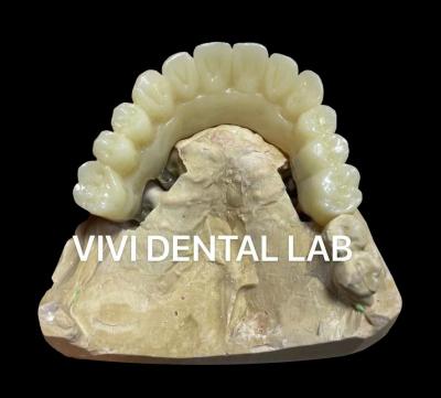 China Implant Temporary Crown And Bridge Dental PMMA Vita Shade for sale