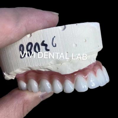 China Natural Looking Esthetic Screw Retained Zirconia Implant Crown Long Lasting for sale