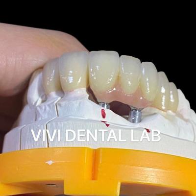 China Porcelain Zirconia Dental Implant Bridge Professional High Esthetics for sale