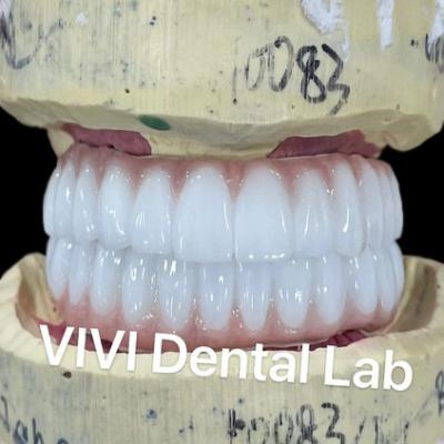 China Ni Be Free Zirconia Dental Implant Bridge On Bar High Esthetics for sale