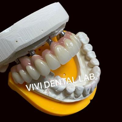 Cina Implantazione dentale di cemento corona professionale perfetta adatta FDA certificato in vendita