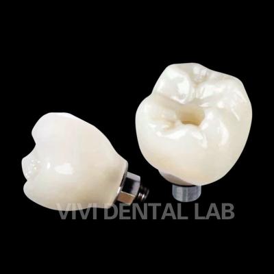 China Screw Retained Dental Implant Crown PFZ Porcelain Layered Zirconia for sale