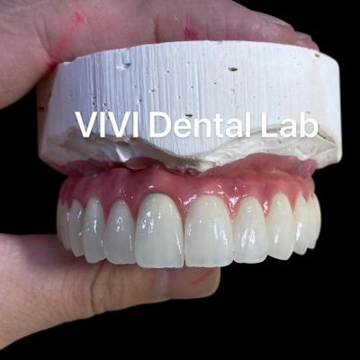 China Implant Metal Ceramic Dental Bridges Screwed Retained With Stump for sale