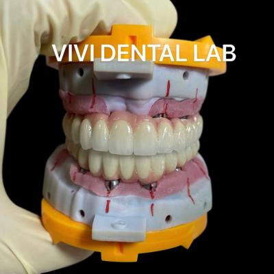 China Ponte de parafuso Implante Dental Ponte da Coroa Ni Ser Livre Sobre Abutments Multi Unidade à venda