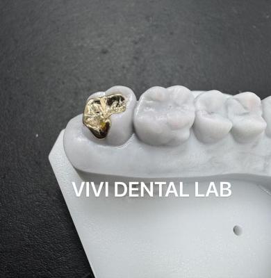 China Coroas dentárias incrustadas incrustadas 74% de ouro à venda