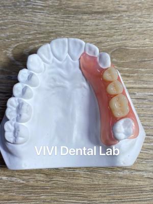 China Alta estética Dentes parciais acrílicos flexíveis / Valplast Dental Parciais à venda