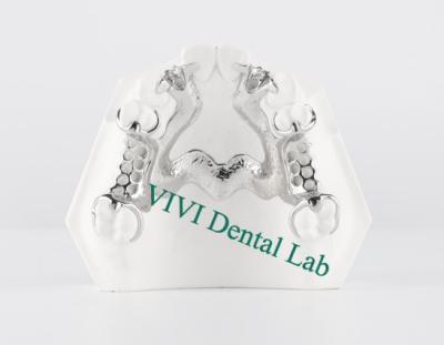 China Esqueleto Cromo Dentadura Parcial de Metal Impressa Dentadura CoCr Design à venda