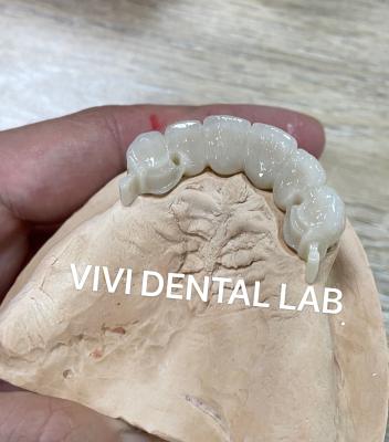 China CAD CAM Attachment Partial Denture Dental Crows And Bridges for sale