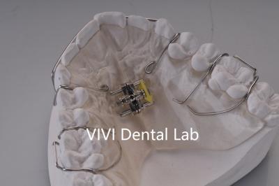 중국 아치 스퀴브 치아 구강 팽창기 완벽한 맞춤 치아 정형 구강 팽창기 판매용