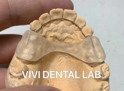 China Gebonden draad tanden orthodontische retainer Permanente professionele Te koop