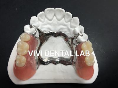 China Quadro de Dentadura Parcial de Metal de Ligação 3 Forma Impressão a Laser Exocad à venda