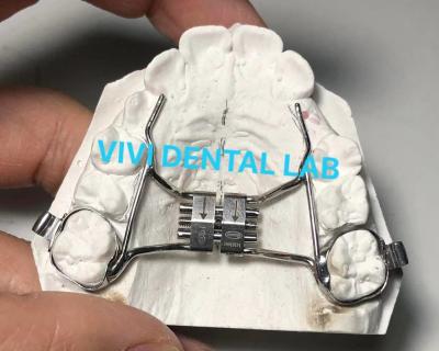 China Arco de los dientes Expandir el paladar estable Hyrax Expandir el paladar ajuste perfecto en venta