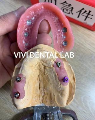 Cina Accoppiamento di precisione dentale Parziale Dentatura Accoppiamenti di precisione dentale professionale in vendita