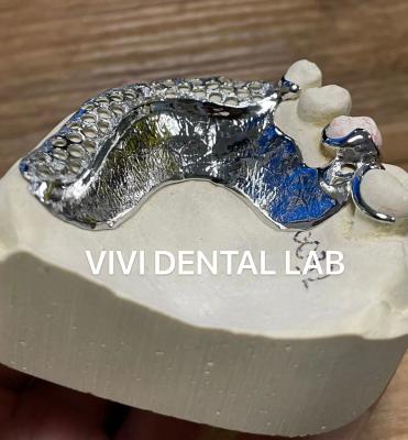 China Laser Printing Cobalt Chrome Partial Denture Framework Ni Be Free for sale