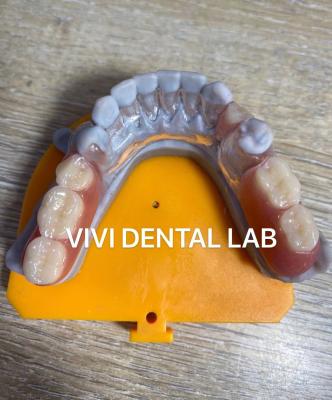 China Flexible Clear Metal Partial Denture Frameworks High Esthetics for sale