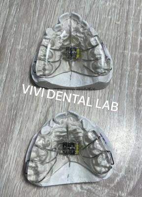 China Arco de tornillo Dental Dientes expansores de paladar tipo ortopédico extraíble en venta