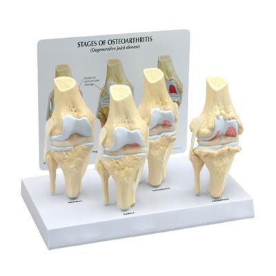 Chine Modèle squelettique médical d'anatomie de Human Pathology Knee de modèle de simulation de PVC à vendre