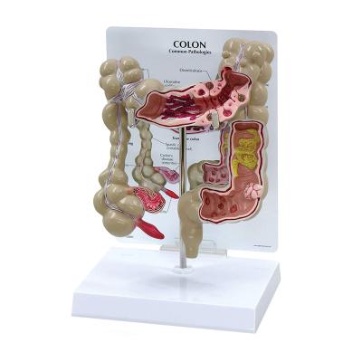 China Modelo de enseñanza humano For School de la anatomía del intestino grueso de los suministros médicos avanzados y hospital en venta