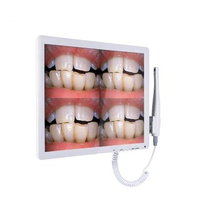 China Dental Image WWG-200 Other Dental Equipments WIFI Intraoral Camera Dental Chair for sale