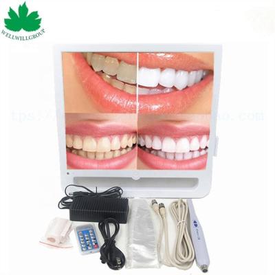 China With webcam WWG-8801 17 inches dental lcd monitor intraoral camera for sale