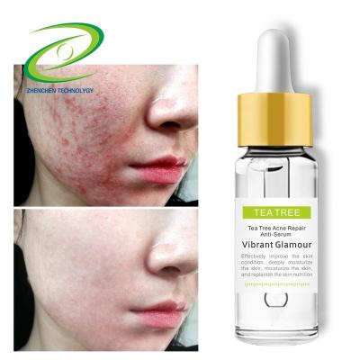 China OEM ODM Private Label Anti Aging Pore Tightening Anti Acne Repair Tea Tree Oil Facial Serum For Skin for sale