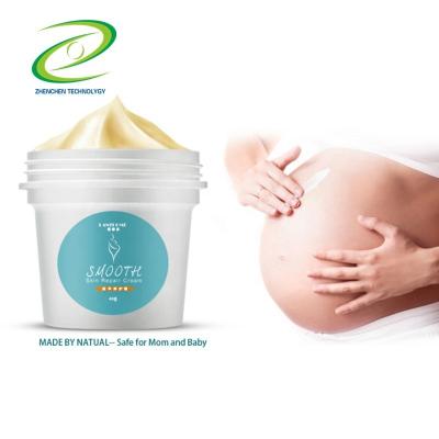 China Exfoliator Private Label Body Skin Care Afy Pregnancy Repairing Aging Stretch Mark Removal Cream Best Maternity Anti Wrinkle Repair Cream for sale