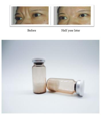 China Injectable PLLA Poly-L-Lactic Acid Dermal Filler Remove Facial Wrinkles Stimulate Collagen Regeneration for sale