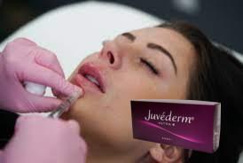 China Face Lip Hyaluronic Acid Dermal Filler Injections Juvederm Ultra 3 12 Months for sale