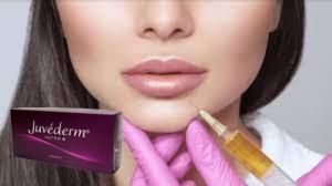 Chine Juvederm Ultra 4 Acide hyaluronique Remplisseurs labiales Injections Amélioration des lèvres à vendre