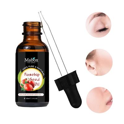 China OEM Private Label Dark Pure Natural Rosehip Oil Anti Wrinkle Circles Organic Cold Pressed Whitening Rosehip Seed Oil 30ml for sale