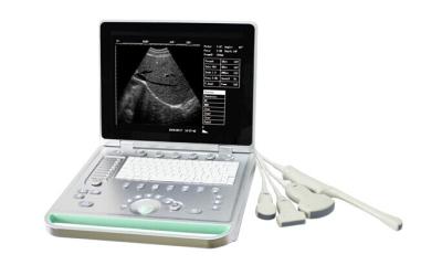 China Laptop Ultrasound scanner black and white Laptop ultrasound machine system for sale