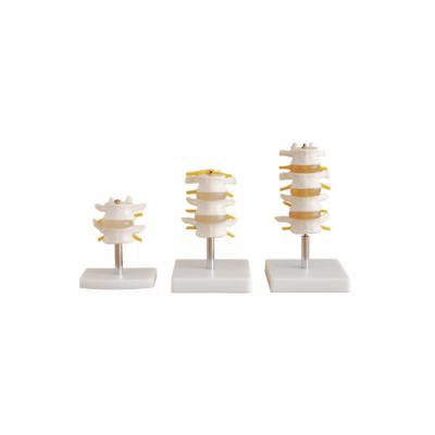 China Medical Teaching Plastic Spine Model PVC Flexible Spine Model 4 Pcs Lumbar Model for sale