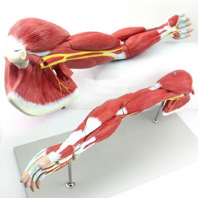 China Realistic contact the upper limb dissection model for sale