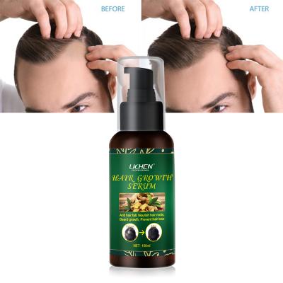 China Organic Professional Hair Loss Treatment Hair Growth Serum For Hair Loss Problem for sale