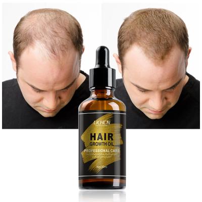 China Chinese Magical Organic Hair Loss Prevention Growth Hair Oil Vitamins Hair Thickening Oil Moroccan Hair Products for sale