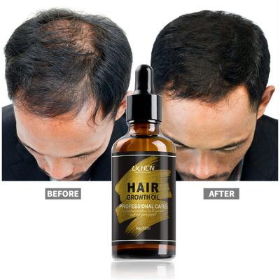 China Wholesale Hot Selling Hair Loss Prevention Hair Loss Control Oil Hair Growth Oil For African Hair for sale