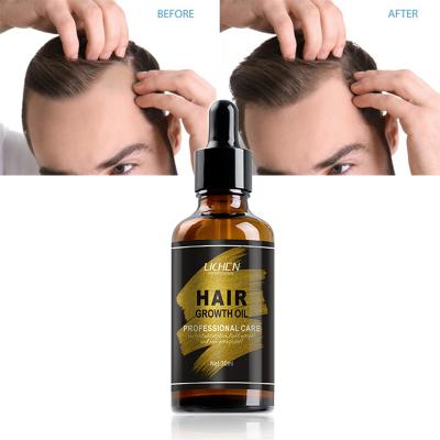 China Hot Selling China Hair Growth Loss Prevention Natural Indian Oil Custom Logo Herbal Oil For Men Hair Growth for sale