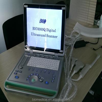 China Portable Ultrasound Machine /Laptop 4d/3d/2d Ultrasound Scanner 3000Q for sale