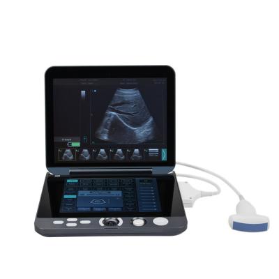 China Full Metal Ultrasound Equipment Laptop Mobile Diagnostic Ultrasound Machine With One Probe Connector for sale