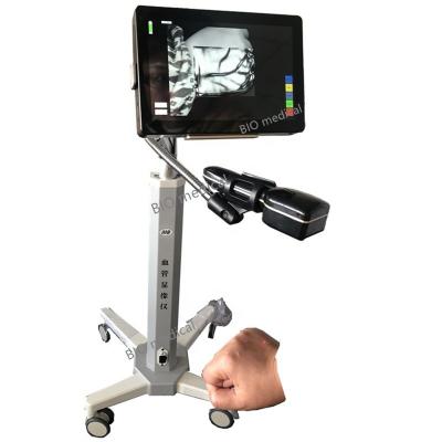 China Hospital Medical Ordinary Handheld Injection Equipment Portable Infrared Diagnosis Vein Viewer BS6000 for sale