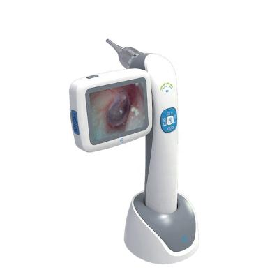 China 3 inch acrylic screen portable ENT camera for eardrum examining nasal cavity and throat with 640*480 resolution for sale