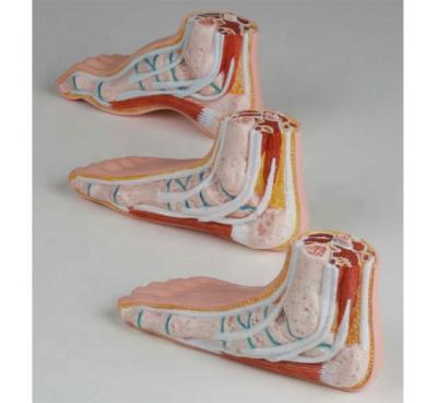 China Durable Human Normal And Abnormal Suit Feet, Anatomy Model 3 Set for sale